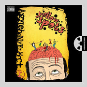 AgylebenyFlört (Brain Lobe Flirt)